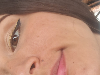 Otras