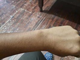 Blackdick042