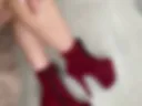 Legs