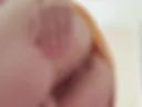 holes