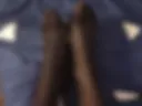 Legs
