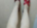 legs mesh