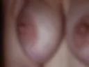 nipples