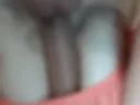 Breast and penis