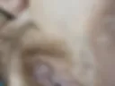 Hair4