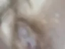 Hair