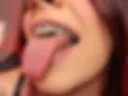 IF U MISS LY WITH BRACES
