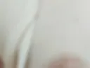 papilla