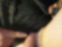 Mein intim Implantat