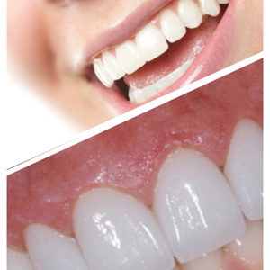 Teeth (implantation, aesthetics, necessity)