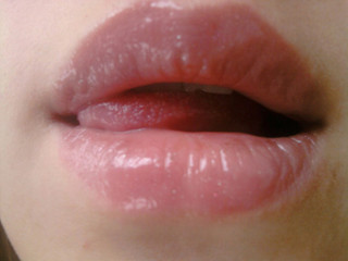 My Photos