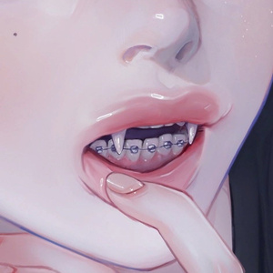 braces / braces