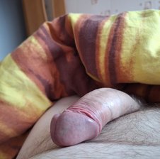 mka62