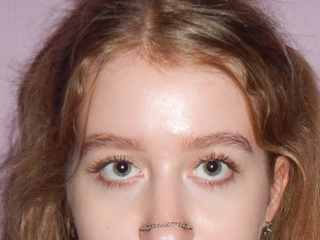 My Photos
