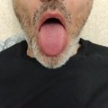 ysn0