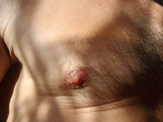 Nipples