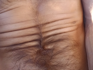 Stomach