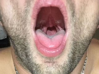 Mouth3