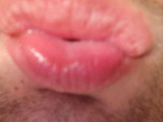 Kiss