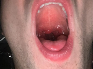 SexyRedLipsOpenMouth