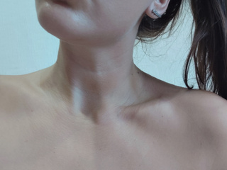 My Photos