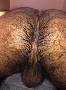 hairy1234 My Photos photo 15168356