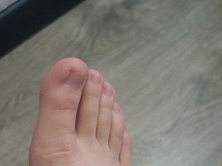Kiss My feet? 🥰