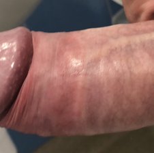 Purethickhardshaft