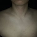 XIZLLOLLZIX