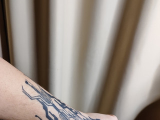 20