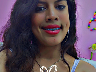Kiss