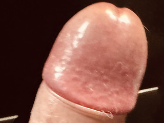 123