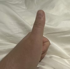 Dpbl1