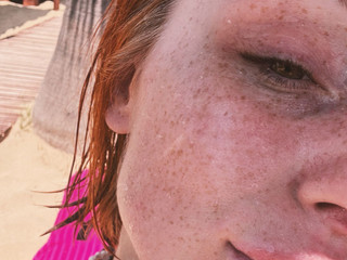 Cuteness with a kink