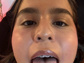 gag
