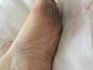 Mes petits pieds sales
