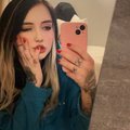 emma-andersonn