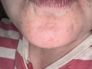 My Photos