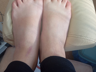 Nails feet