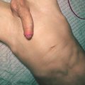 THEDARK