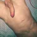 THEDARK