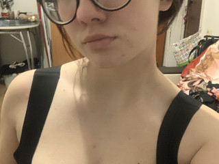 :3