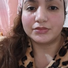 BellaFoxs-1