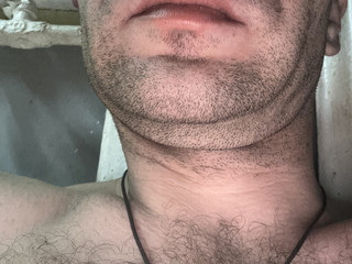 My Photos