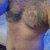 Pelon8