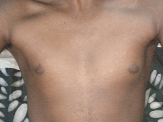My Photos