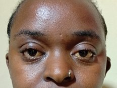 Candyers Live Webcam on BongaCams