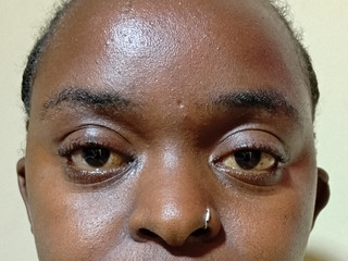 My Photos