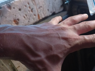 Veins on the hands