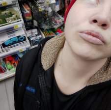 Turbolizka